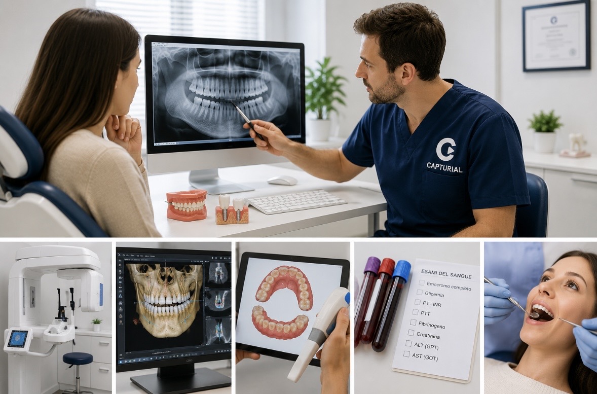 Esami prima di rifare tutti i denti e pianificazione implantare