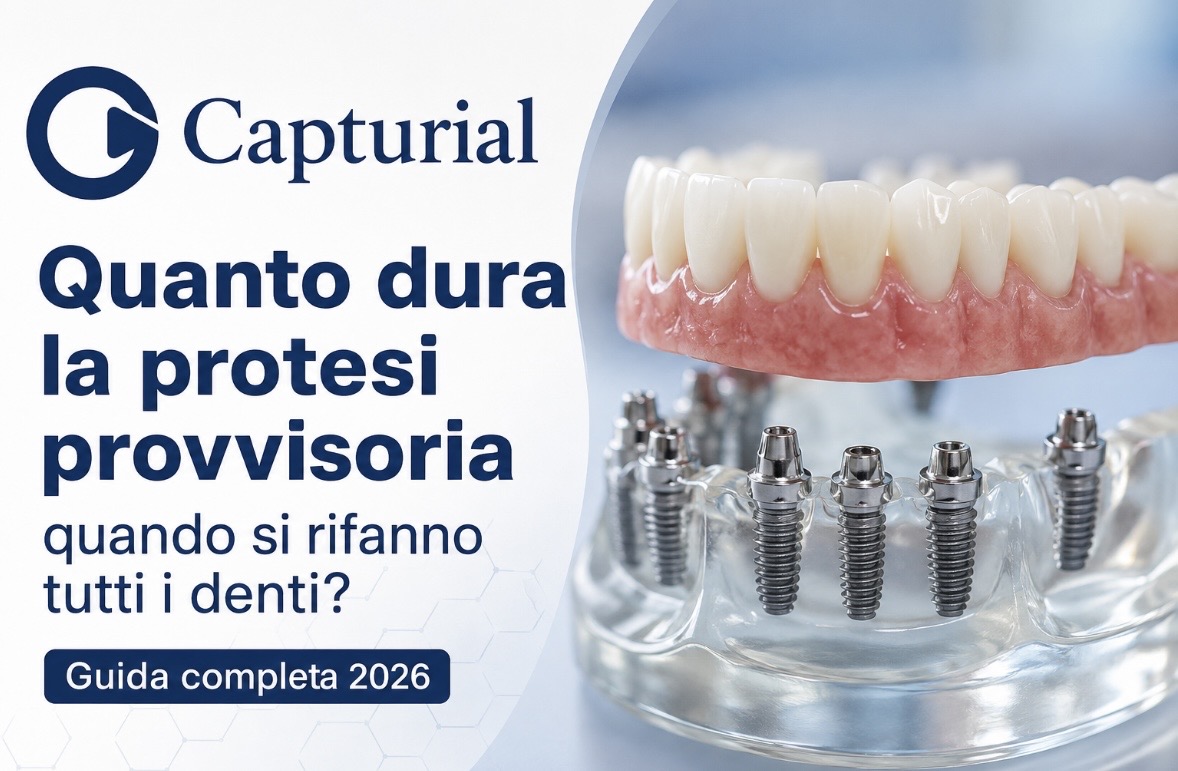 Quanto dura la protesi provvisoria quando si rifanno tutti i denti